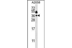 VP7 Antibody (Center) (ABIN657786 and ABIN2846760) western blot analysis in  cell line lysates (35 μg/lane). (VAMP7 anticorps  (AA 51-80))
