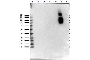 Western blot results of Mouse Anti-HbS Antibody.