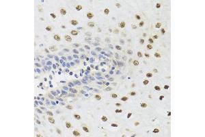 Immunohistochemistry of paraffin-embedded human esophagus using YTHDF3 antibody (ABIN5974579) at dilution of 1/100 (40x lens).