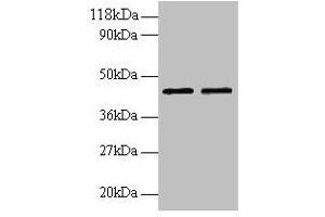 Western blot All lanes: B4GALT3 antibody at 2 μg/mL Lane 1: EC109 whole cell lysate Lane 2: 293T whole cell lysate Secondary Goat polyclonal to rabbit IgG at 1/15000 dilution Predicted band size: 44, 16 kDa Observed band size: 44 kDa (B4GALT3 anticorps  (AA 34-393))