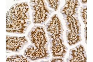 ABIN6261968 and ABIN6277736 at 1/100 staining Rat colon tissue by IHC-P. (GLI1 anticorps  (C-Term))