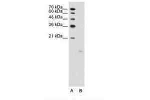 Image no. 1 for anti-PTPRF Interacting Protein, Binding Protein 1 (Liprin beta 1) (PPFIBP1) (AA 41-90) antibody (ABIN203505) (PPFIBP1 anticorps  (AA 41-90))