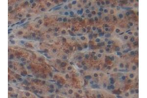 Detection of NME6 in Rat Stomach Tissue using Polyclonal Antibody to Non Metastatic Cells 6, Protein Expressed In (NME6)