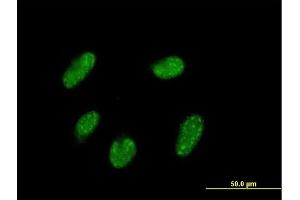 Immunofluorescence of purified MaxPab antibody to VENTX on HepG2 cell.