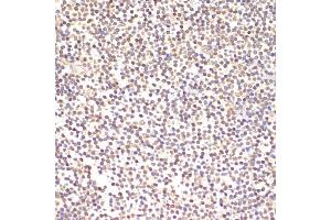 Immunohistochemistry of paraffin-embedded human tonsil using TI antibody (2517) at dilution of 1:100 (40x lens). (TIA1 anticorps  (AA 1-193))