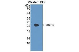 Detection of Recombinant SCEL, Human using Polyclonal Antibody to Sciellin (SCEL) (SCEL anticorps  (AA 519-685))