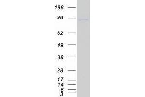 Validation with Western Blot