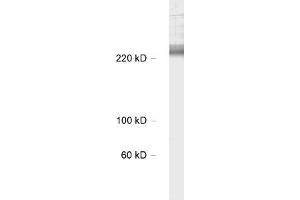 antibody dilution: 1 : 1000, sample: rat hippocampus lysate (CACNA1B anticorps  (alpha-1E subunit))