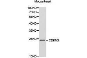 Western Blotting (WB) image for anti-Cyclin-Dependent Kinase Inhibitor 3 (CDKN3) antibody (ABIN1871769) (CDKN3 anticorps)
