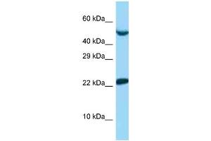 WB Suggested Anti-UBE2E1 Antibody   Titration: 1. (UBE2E1 anticorps  (N-Term))