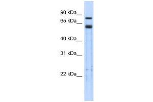 WB Suggested Anti-TRIM9 Antibody Titration:  0. (TRIM9 anticorps  (Middle Region))