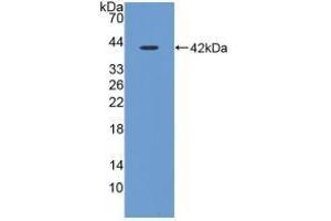 Detection of Recombinant CST3, Porcine using Polyclonal Antibody to Cystatin C (Cys-C) (CST3 anticorps  (AA 42-127))