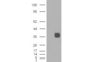 HEK293 overexpressing CD32 (RC211982) and probed with ABIN185377 (mock transfection in first lane), tested by Origene.