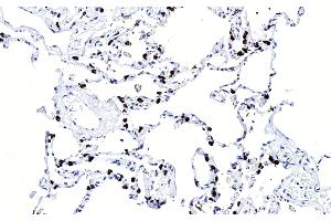 Immunohistochemical analysis of paraffin-embedded Human lung section using SFTPC Antibody (ABIN656267 and ABIN2845580).