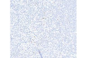 Immunohistochemistry (IHC) image for anti-Forkhead Box P3 (FOXP3) (AA 275-325) antibody (ABIN7455209)