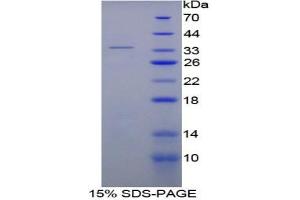 SDS-PAGE of Protein Standard from the Kit (Highly purified E. (SERPINC1 Kit ELISA)