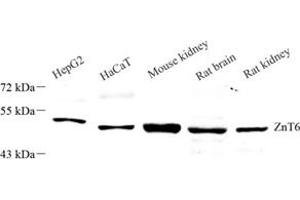 Western blot analysis of Znt6 (ABIN7075673),at dilution of 1: 1000 (SLC30A6 anticorps)