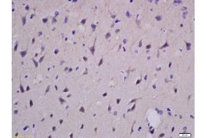 Formalin-fixed and paraffin embedded rat brain labeled with Rabbit Anti-EphA2 Polyclonal Antibody, Unconjugated  at 1:100 followed by conjugation to the secondary antibody and DAB staining