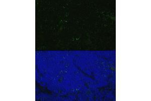 Immunofluorescence analysis of Rat thymus cells using CD4 antibody (ABIN6132069, ABIN6138186, ABIN6138188 and ABIN6213820) at dilution of 1:100.