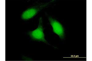 Immunofluorescence of purified MaxPab antibody to PSME2 on HeLa cell. (PSME2 anticorps  (AA 1-239))