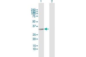 Western Blot analysis of RIMKLB expression in transfected 293T cell line by RIMKLB MaxPab polyclonal antibody. (RIMKLB anticorps  (AA 1-307))