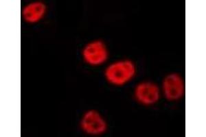 ABIN6275860 staining HepG2 by IF/ICC. (VRK3 anticorps  (Internal Region))