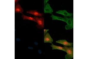 ABIN6258843 and ABIN6274212 staining  cells(H2O2 treatment) by IF/ICC. (HMGB2 anticorps  (Internal Region))