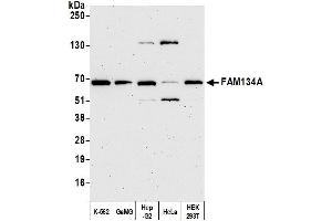 anti-Family with Sequence Similarity 134, Member A (FAM134A) (AA 493-543) antibody
