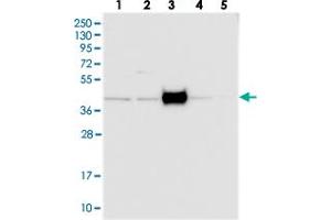 Western blot analysis of Lane 1: RT-4, Lane 2: U-251 MG, Lane 3: Human Plasma, Lane 4: Liver, Lane 5: Tonsil with FAM154B polyclonal antibody  at 1:250-1:500 dilution. (FAM154B anticorps)