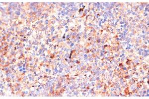 Immunohistochemistry of paraffin-embedded Mouse spleen using IL4R Polyclonal Antibody at dilution of 1:100 (40x lens). (IL4 Receptor anticorps)