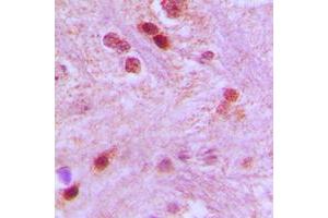 Immunohistochemical analysis of GTF3C3 staining in human brain formalin fixed paraffin embedded tissue section.