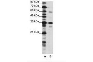 Image no. 1 for anti-CAMP Responsive Element Binding Protein 3-Like 1 (CREB3L1) (N-Term) antibody (ABIN202706) (CREB3L1 anticorps  (N-Term))