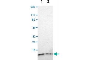 Western Blot analysis of Lane 1: RT-4 and Lane 2: U-251MG sp cell lysates with TIMM8A polyclonal antibody . (TIMM8A/DDP anticorps)