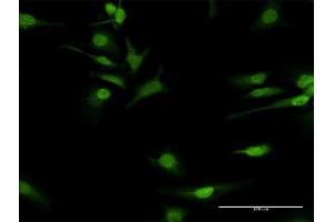 Immunofluorescence of purified MaxPab antibody to COQ3 on HeLa cell.