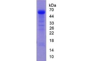 SDS-PAGE of Protein Standard from the Kit (Highly purified E. (Angiotensin I Converting Enzyme 1 Kit CLIA)