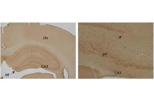 Rat Brain (ESR2 anticorps  (N-Term))