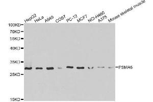 Western blot analysis of extracts of various cell lines, using PSMA6 antibody. (PSMA6 anticorps  (AA 1-246))
