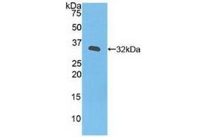 Detection of Recombinant JAK3, Human using Polyclonal Antibody to Janus Kinase 3 (JAK3) (JAK3 anticorps  (AA 716-967))