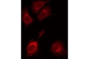 ABIN6275568 staining HuvEc by IF/ICC. (SH3RF3 anticorps  (C-Term))