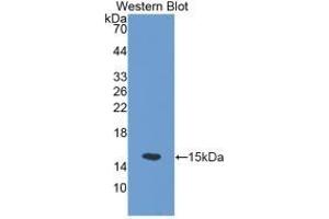 Detection of Recombinant SLC30A5, Mouse using Polyclonal Antibody to Solute Carrier Family 30, Member 5 (SLC30A5) (SLC30A5 anticorps  (AA 639-751))