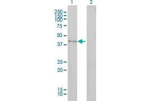 Western Blot analysis of DNMT2 expression in transfected 293T cell line by DNMT2 monoclonal antibody (M01), clone 1E12.