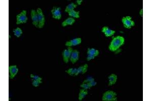 Immunofluorescence staining of HepG2 cells with ABIN7139920 at 1:100, counter-stained with DAPI.