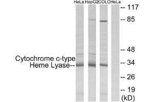 Western blot analysis of extracts from HeLa cells, HepG2 cells and COLO cells, using Cytochrome c-type Heme Lyase antibody. (HCCS anticorps  (Internal Region))