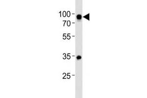Western blot analysis of lysate from Ramos cell line using CD19 antibody at 1:500.