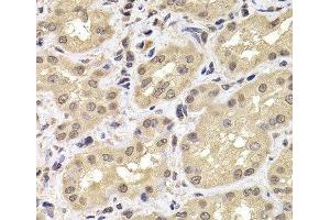 Immunohistochemistry of paraffin-embedded Human kidney using PSMD12 Polyclonal Antibody at dilution of 1:100 (40x lens). (PSMD12 anticorps)