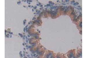 Detection of GSTt2 in Rat Lung Tissue using Polyclonal Antibody to Glutathione S Transferase Theta 2 (GSTt2)