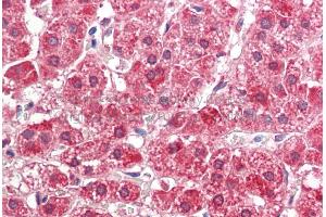 Rabbit Anti-ALDH3A2 antibody  Formalin Fixed Paraffin Embedded Tissue: Human Adult Adrenal  Observed Staining: Cytoplasm in hepatocytes Primary Antibody Concentration: 1:600 Secondary Antibody: Donkey anti-Rabbit-Cy3 Secondary Antibody Concentration: 1:200 Magnification: 20X Exposure Time: 0. (ALDH3A2 anticorps  (Middle Region))