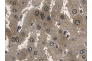 Detection of ALDOA in Human Liver Tissue using Polyclonal Antibody to Aldolase A, Fructose Bisphosphate (ALDOA)