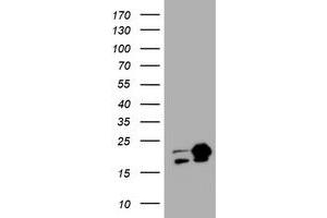 Image no. 7 for anti-Non-Metastatic Cells 1, Protein (NM23A) Expressed in (NME1) antibody (ABIN1499754)