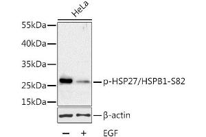 Western blot analysis of extracts of HeLa cells, using Phospho-HSP27/HSPB1-S82 antibody (ABIN3023549, ABIN3023550, ABIN3023551 and ABIN6225403) at 1:1000 dilution.
